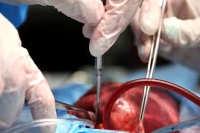 Doctors Perform Surgery on Boy's Private Part Instead of His Injured Leg, Parents Lodge Complaint; Probe On