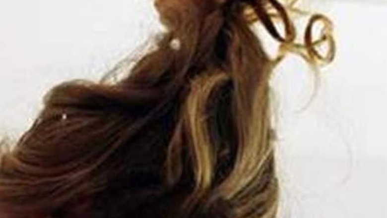 1.8 kg hair removed from girl's stomach in Indore