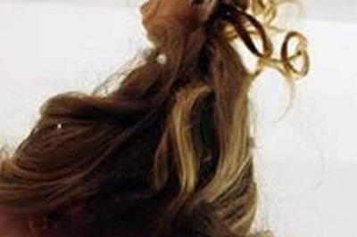 1.8 kg hair removed from girl's stomach in Indore