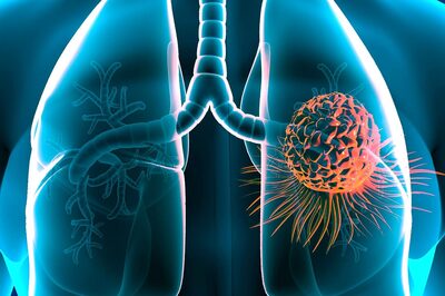 What is World Lung Cancer Day and Why is it Celebrated on August 1?