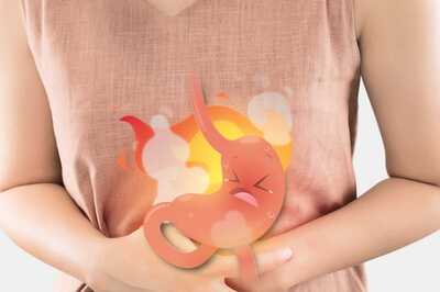 Try These Home Remedies to Get Rid of Acidity