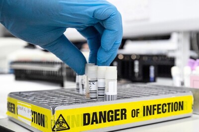 How to Fight Disease X? Covid Panel Chief Lists 4-Point Plan for the Next Pandemic | Exclusive