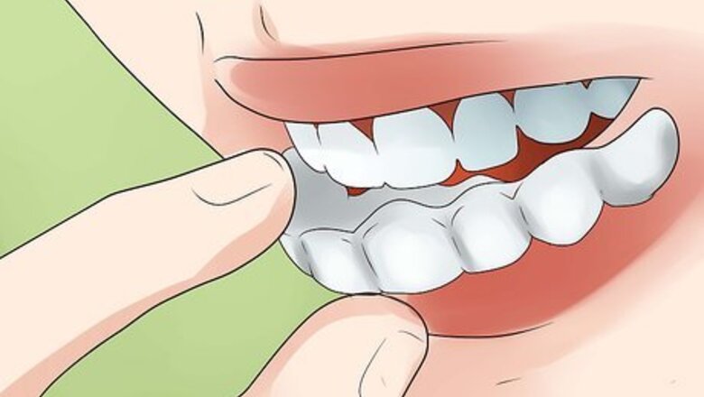 How to Put a New Invisalign Tray In