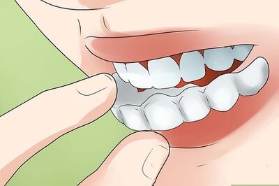 How to Put a New Invisalign Tray In