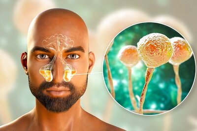 What is Black Fungus and White Fungus? How is it Transmitted? Here's All You Need to Know