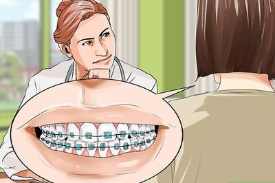 How to Connect a Rubber Band to Your Braces