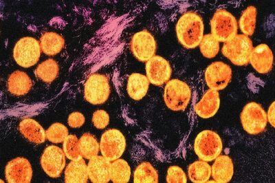 India Now 3rd non-African Nation with ‘Complicated’ Mpox Strain; Centre Asks States, UTs to Boost Efforts