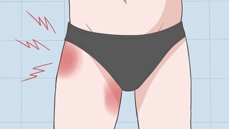How to Diagnose Hip Bursitis