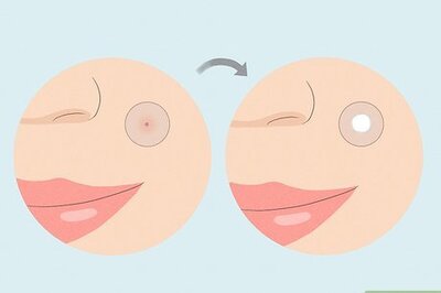 What to Do After Removing a Pimple Patch (+ Tips for Next Time!)