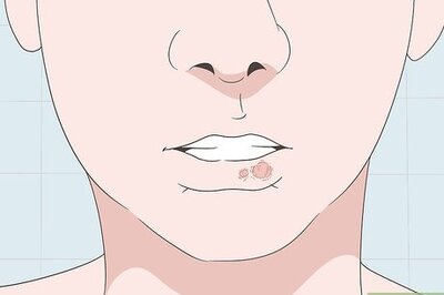 How to Cover Up a Cold Sore