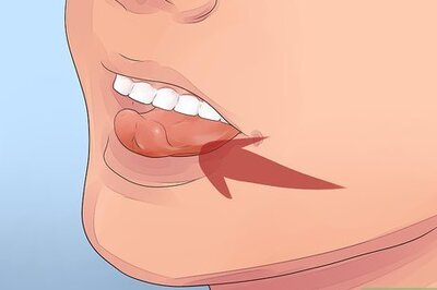 8 Ways to Remove a Loose Tooth without Pulling It