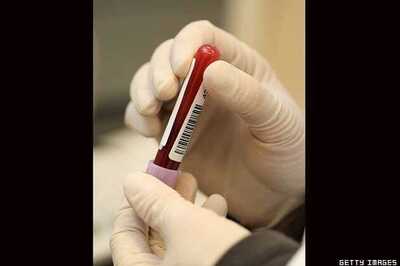 US defends study of blood transfusions for premature babies