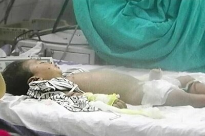 Hospital Blames Technician as Kids Die Due to Anaesthesia-Oxygen Mixup