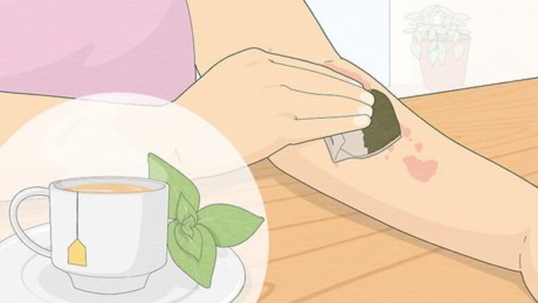 How to Calm Irritated Skin