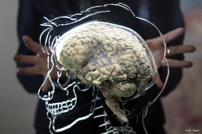 Nano particles protect brain from multiple sclerosis