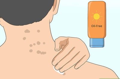 How to Get Rid of Back Acne Scars