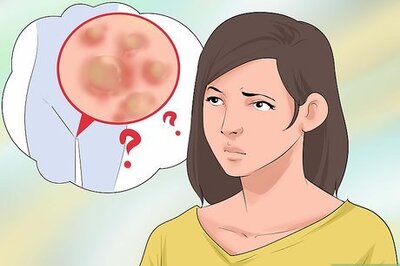 How to Prevent the Spread of Genital Warts