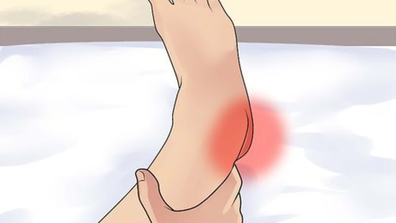 How to Diagnose Heel Spurs
