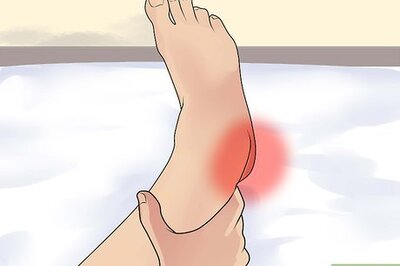 How to Diagnose Heel Spurs