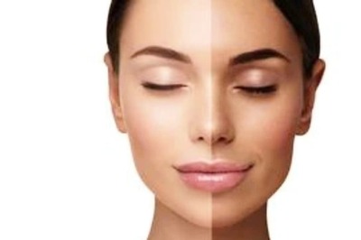 Here Is How You Can Avoid Excessive Body Tans This Summer