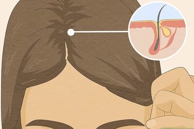 Why Does Hair Get Greasy So Fast? Your Questions, Answered.