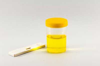 What Makes Urine Yellow? Scientists Have Found The Answer