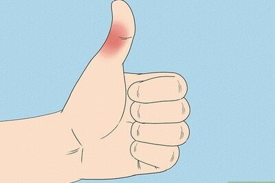 How to Tell if Your Thumb is Broken (with Pictures)