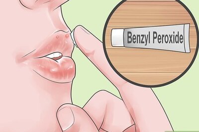 How to Treat Acne Around the Lips Fast